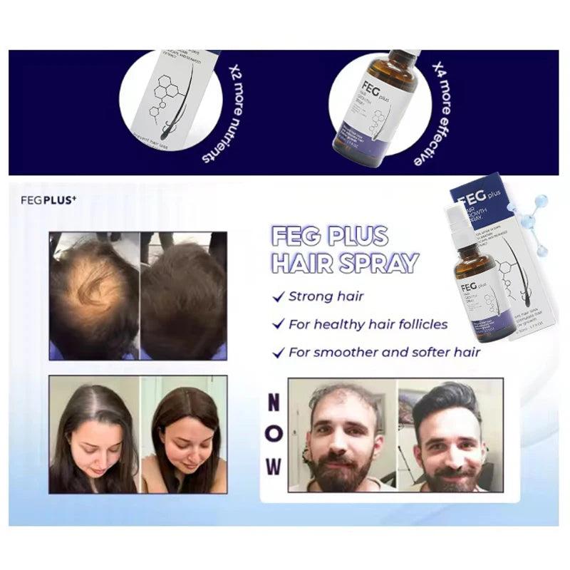 FEG Plus Organic Hair Growth Treatment Oil - زيت فيج بلس العضوي لعلاج نمو الشعر